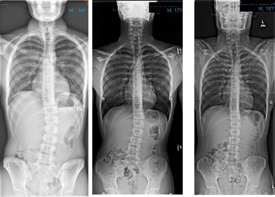 Chiropractic Phoenix AZ X-ray 1