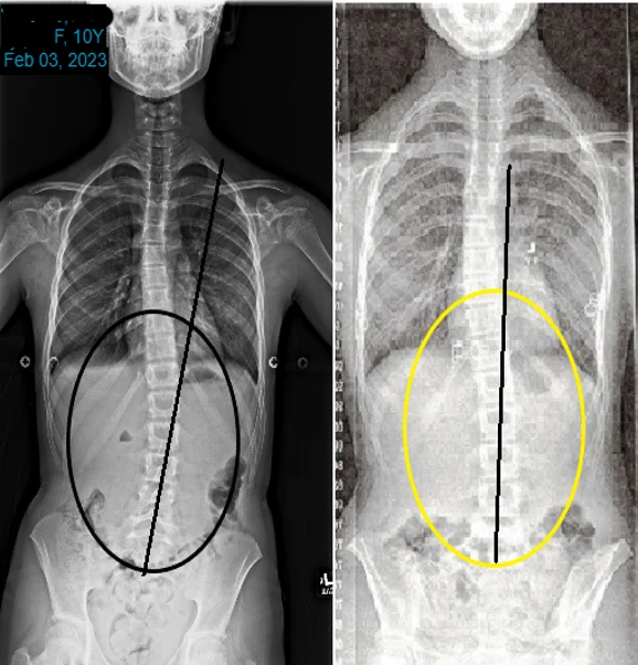 Chiropractic Phoenix AZ X-ray 10