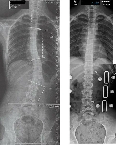 Chiropractic Phoenix AZ X-ray 11