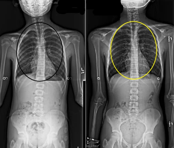 Chiropractic Phoenix AZ X-ray 12