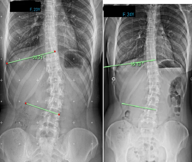 Chiropractic Phoenix AZ X-ray 13