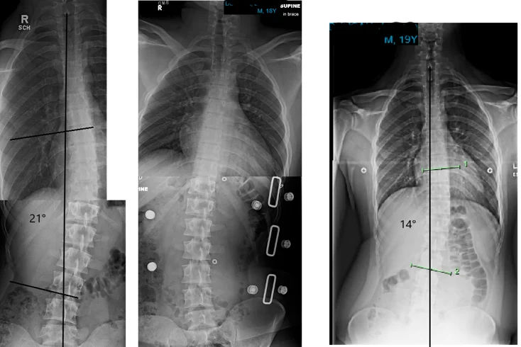 Chiropractic Phoenix AZ X-ray 4