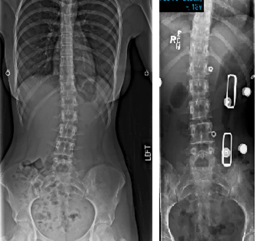 Chiropractic Phoenix AZ X-ray 5