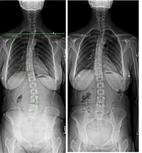 Chiropractic Phoenix AZ X-ray 6