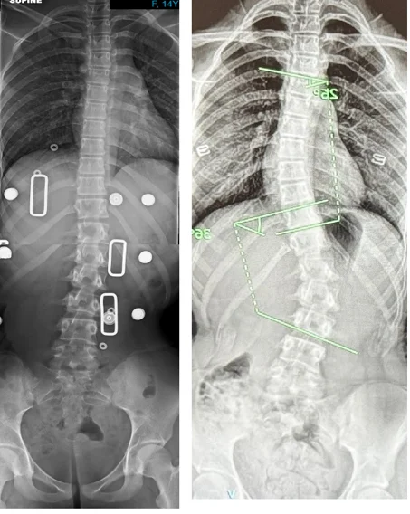 Chiropractic Phoenix AZ X-ray 7