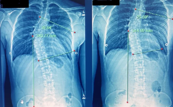 Chiropractic Phoenix AZ X-ray 8