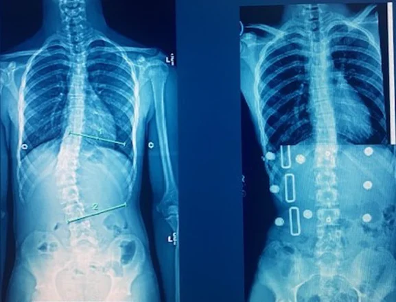 Chiropractic Phoenix AZ X-ray 9